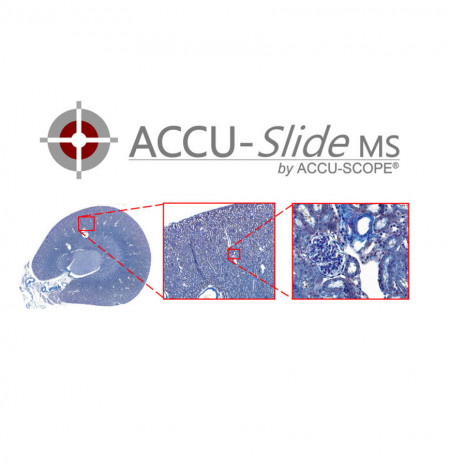 ACCU-SlideMS Manual Slide Scanning System